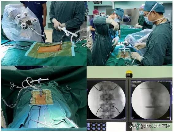 北京友谊医院做甲状腺微创手术,北京友谊医院手术