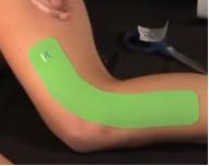 大腿外侧髂胫束综合征快速恢复,跑步如何避免髂胫束综合征