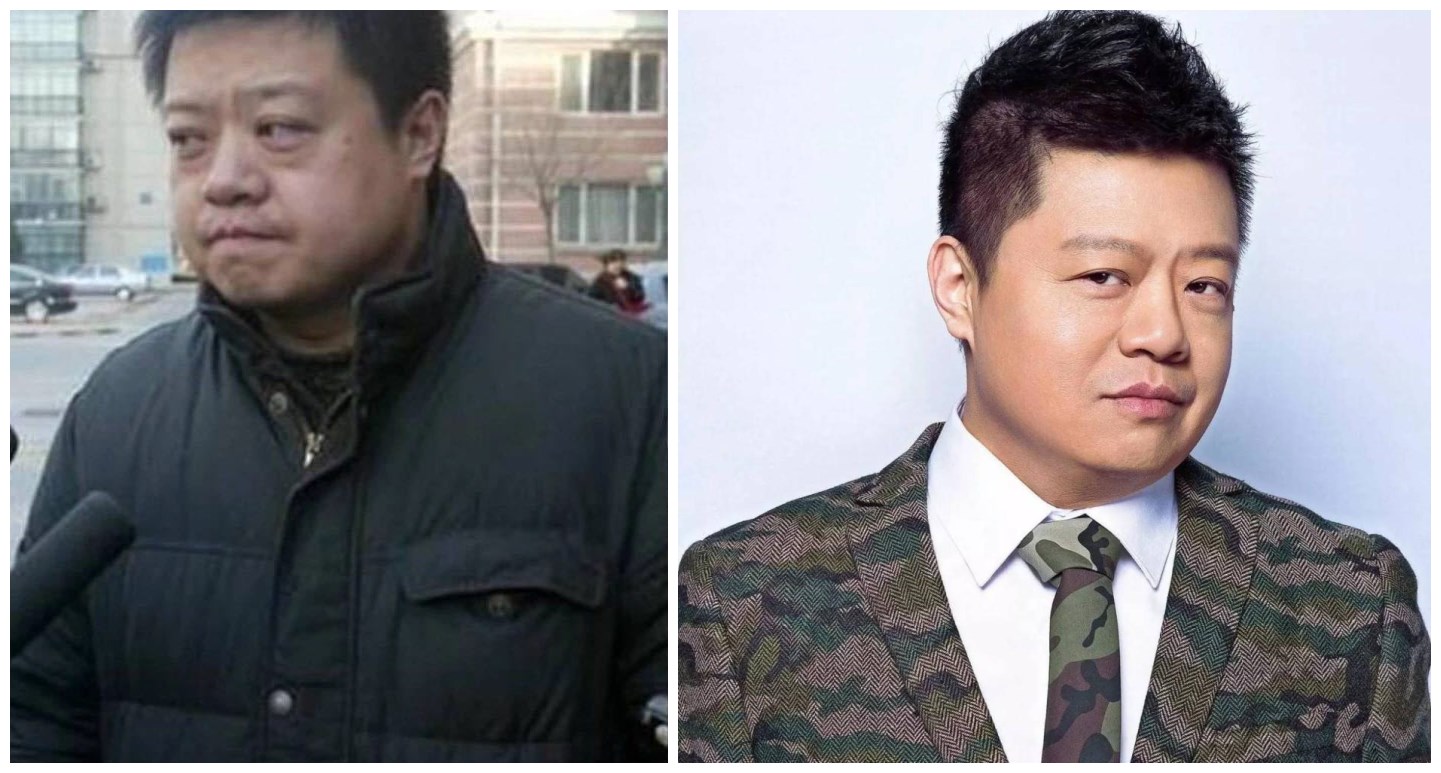 眼袋重显老去眼袋的方法,眼袋显老小妙招