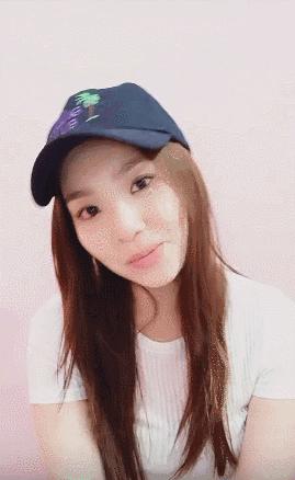 阿娇大龅牙,阿娇整牙