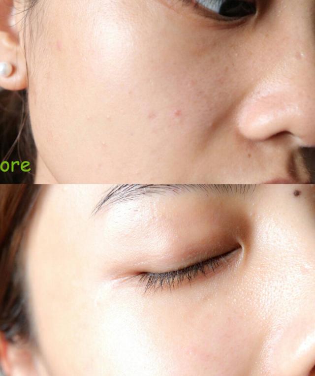 片仔癀雪肌无暇润白精华,片仔癀雪肌精华液