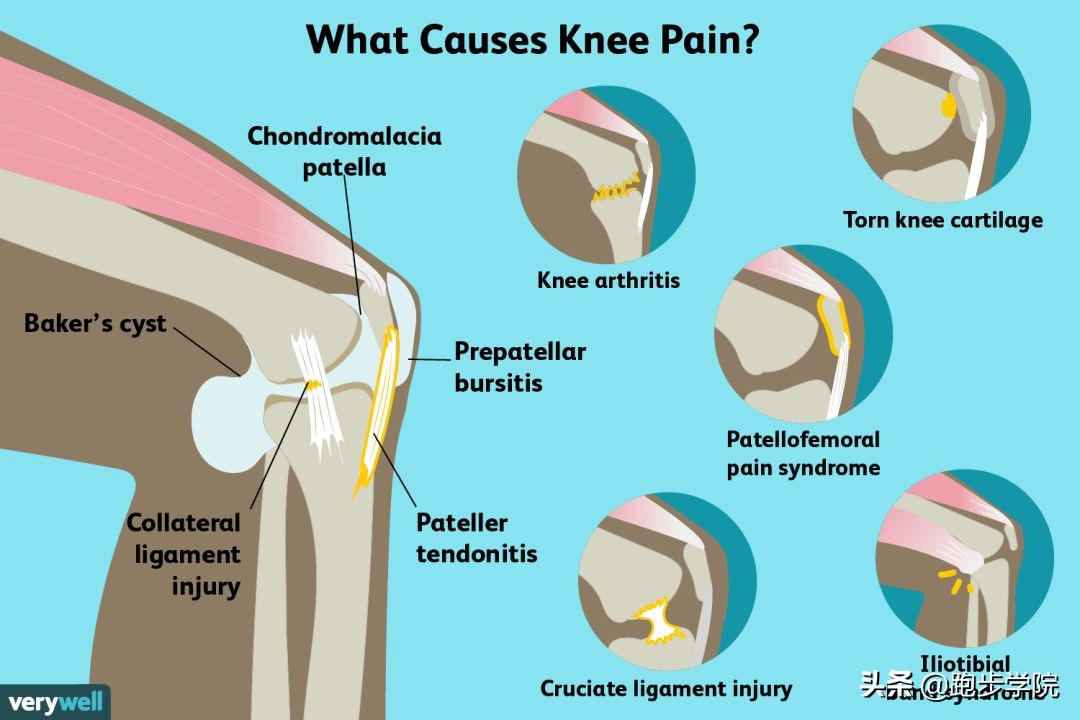 如何拯救腿毛,如何拯救跑步以后的粗腿