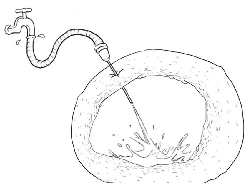 卵巢出现巧克力颜色块,巧克力囊肿长在卵巢上怎么治