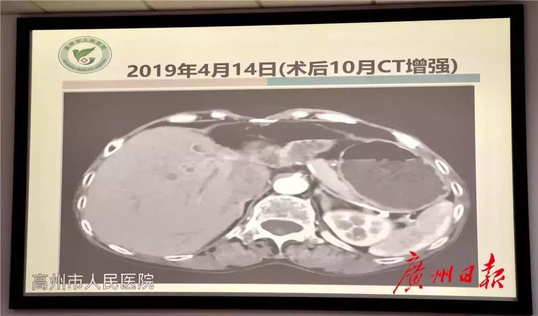 高州有三甲医院,高州市第一中医院