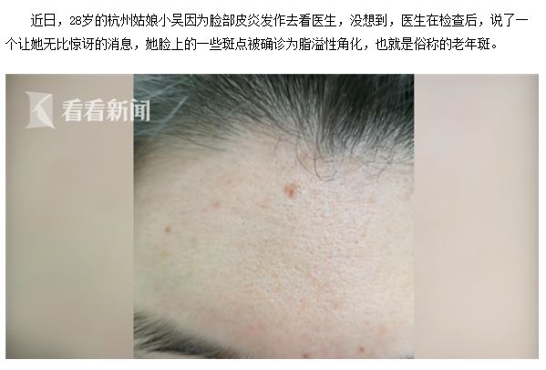 起底老年斑！98岁秦怡为何仍光彩照人？皮肤科主任透露老年人真正护脸“神器”