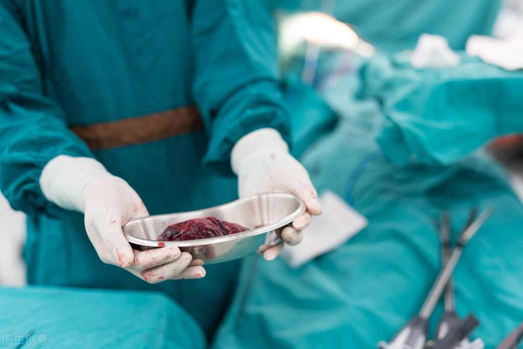 肺鳞癌中期不好动手术可以活多久,肺鳞癌化疗后可以中医调理吗