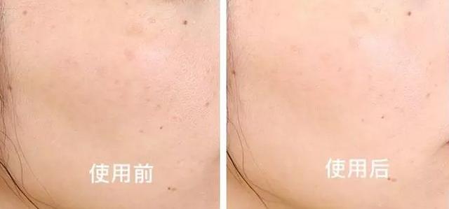 黄圣依洗面奶,黄圣依洗面奶真的有效果吗