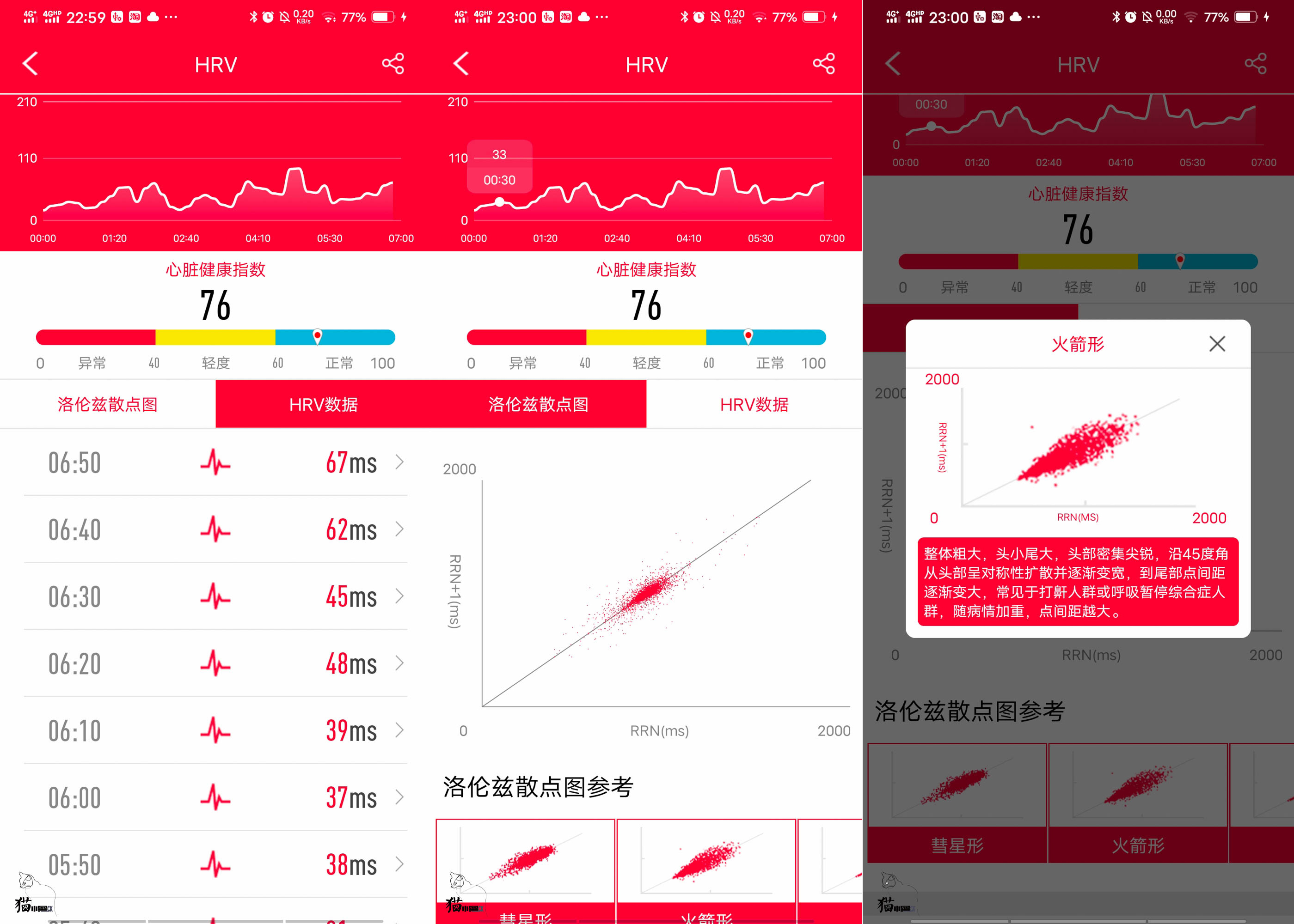 医疗级智能手环,didof11智能血压手环测评