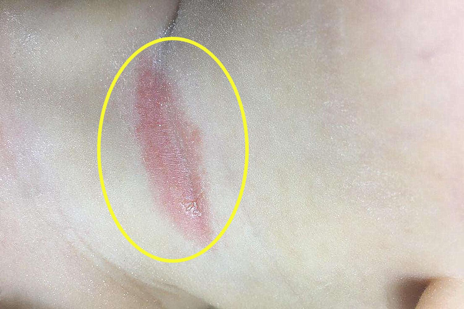 宝宝“淹脖子”太受罪,新手妈妈无从下手,最有用的护理方法在这