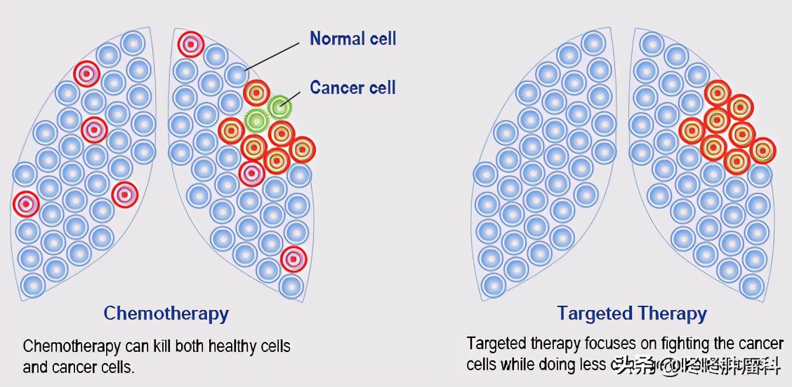肺癌吃靶向药一年多少钱,腺性肺癌的靶向药多少钱