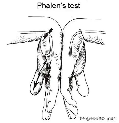 颈椎痛手臂麻有几种治疗方法,颈椎病手麻按脖子的哪一根筋