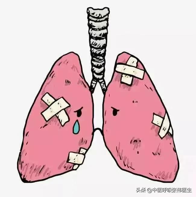 肺出血肾炎综合征有多罕见,肾炎肺出血综合征