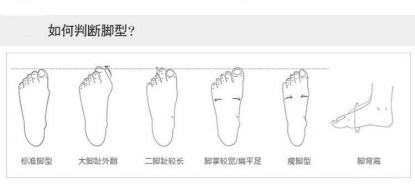 扁平足脚跟突出选什么鞋,拇外翻患者如何选择合适的鞋
