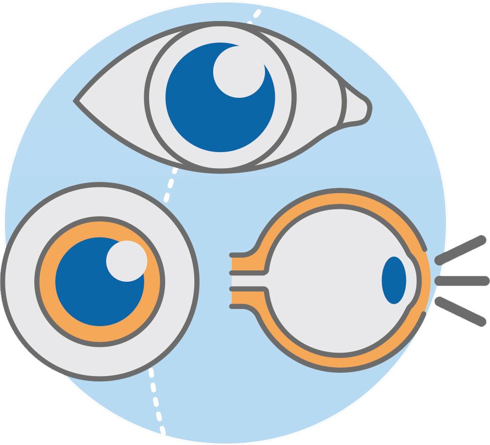 验光配镜必知的10个小常识,验光怎么才精准