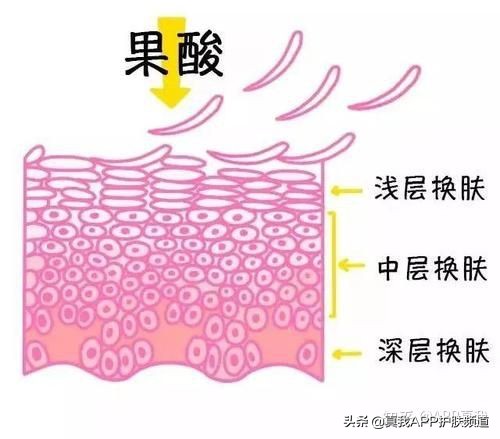 维a酸药膏治疗痘痘效果,中成药维a酸类口服药有哪些