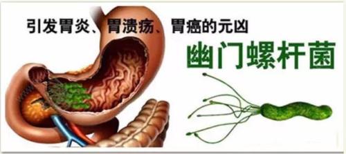 一半中国人感染的幽门螺旋杆菌怎么根治?