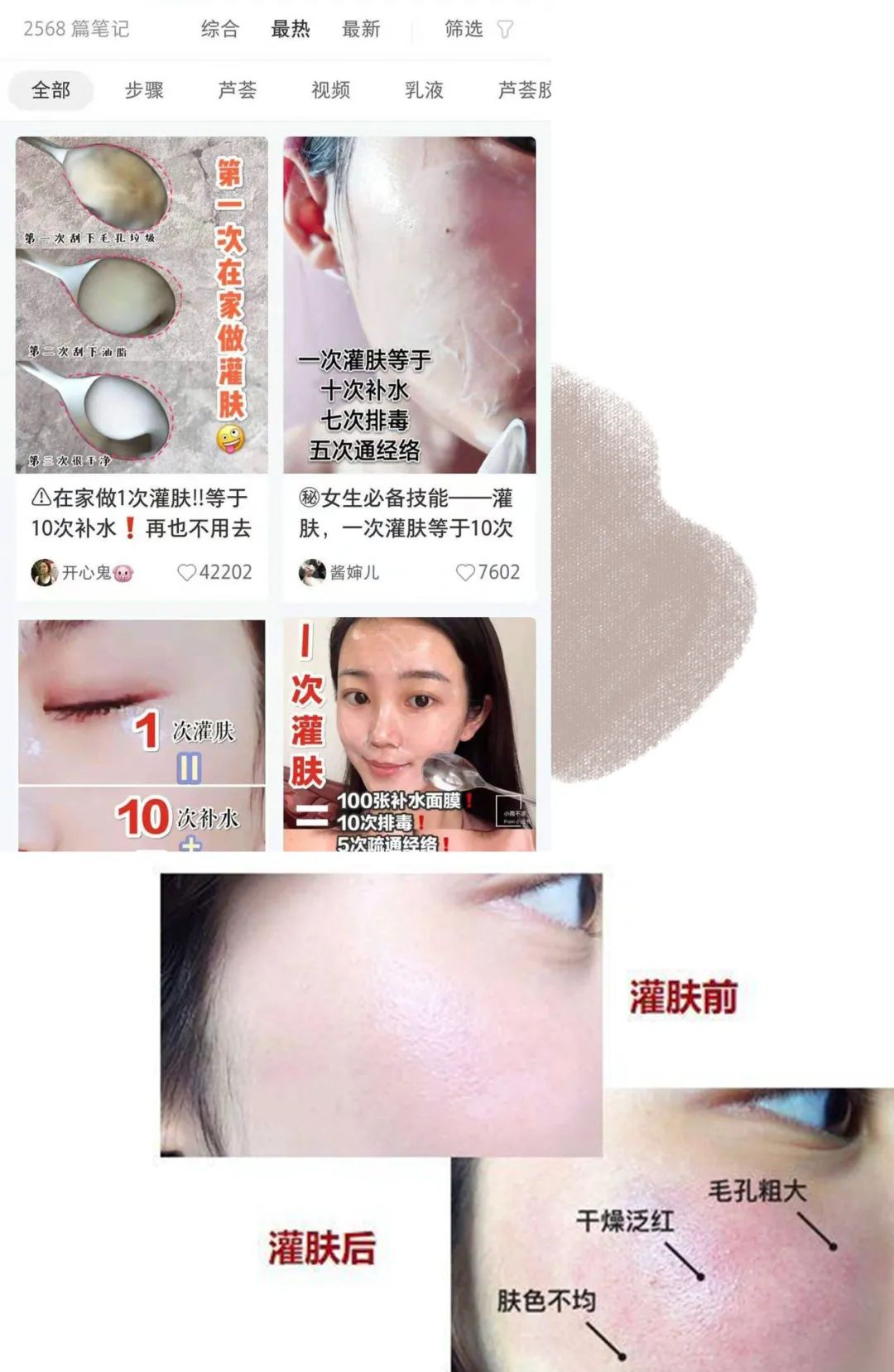 半永久粉底驻颜手法,脸部半永久粉底