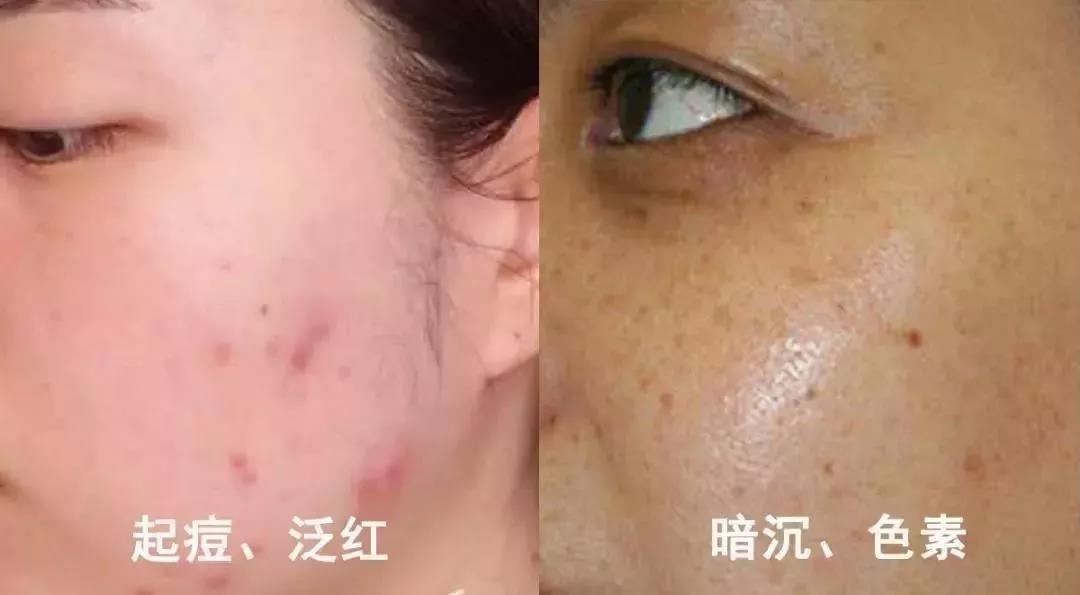 东时名品|为什么这款韩国进口美嫩雅面膜受那么多人追捧？