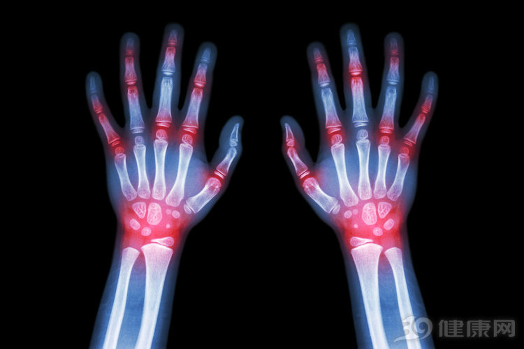 经常喝啤酒的人身体出现三个症状,每天晚上三瓶啤酒身体变化