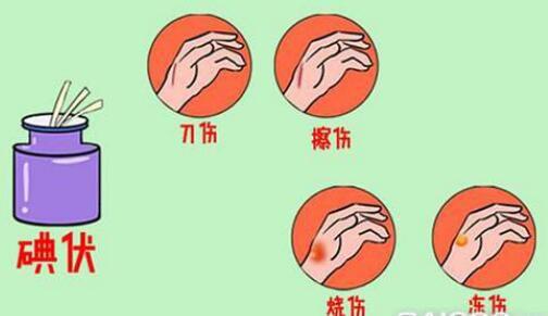 防治腱鞘炎最好的动作,预防腱鞘炎的关键有哪些