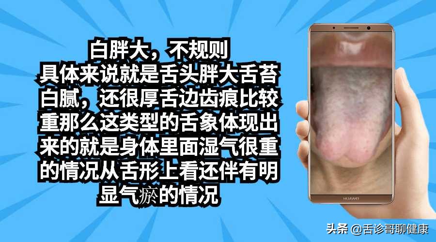 抖音舌诊哥,舌诊歌舌象分析和感悟