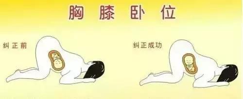 孕妇胎位不正多少周纠正胎位,胎位不正臀位纠正操37周