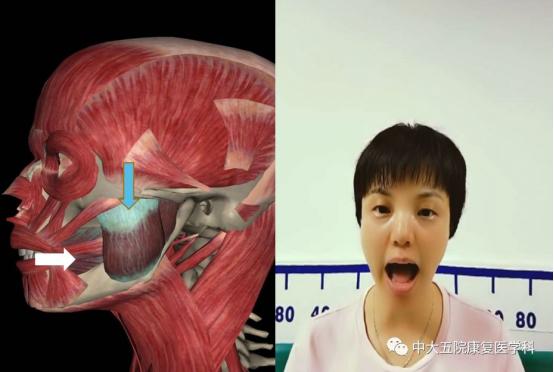 面瘫临床表现的科普视频,科普面瘫多久治疗效果最好