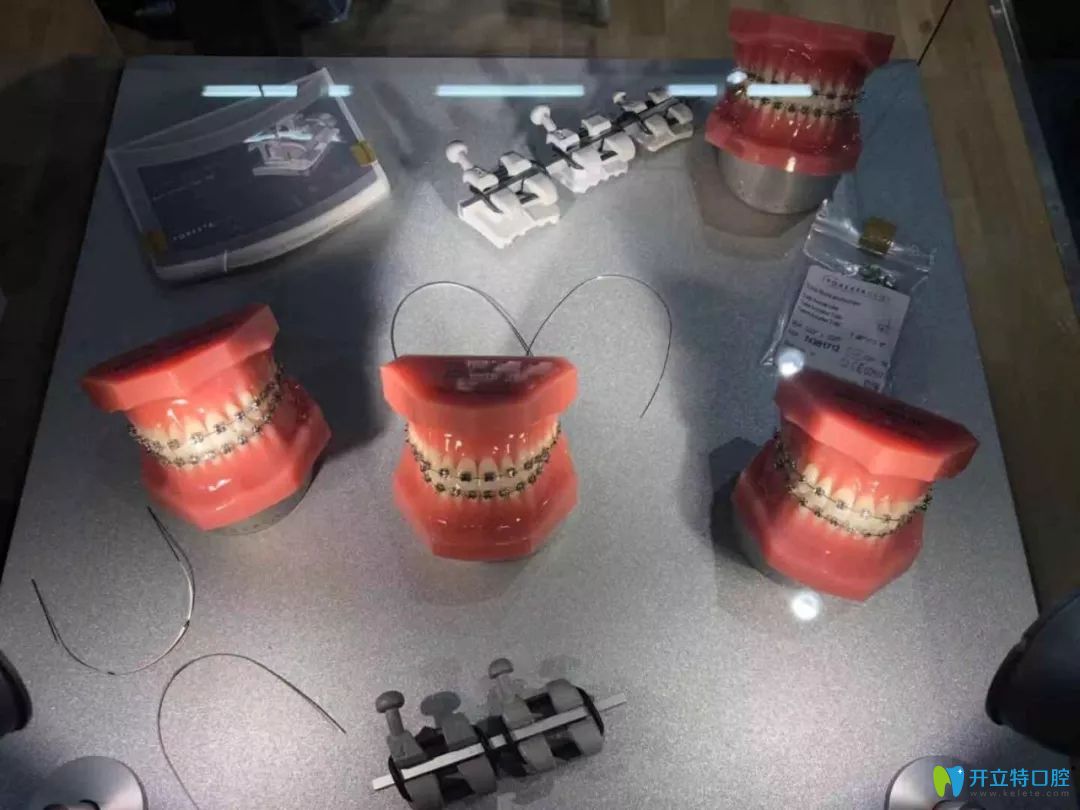 德国飞凡自锁托槽和国产区别,自锁金属牙套品牌有区别吗