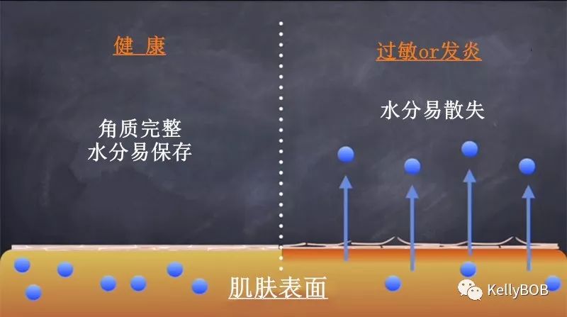 你的肌肤正处于慢性过敏？因为过度护肤！如何正确的护肤！