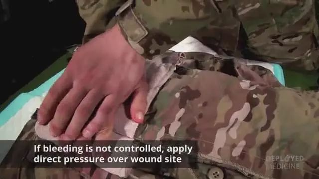 突破传统止血局限：美军战场止血利器X-stat