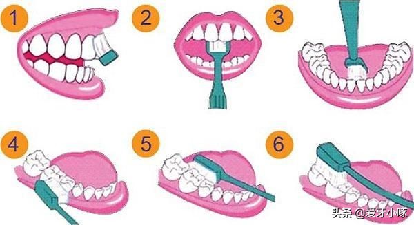 2岁宝宝牙齿坏掉视频,2岁宝宝牙齿坏的只剩牙根怎么办