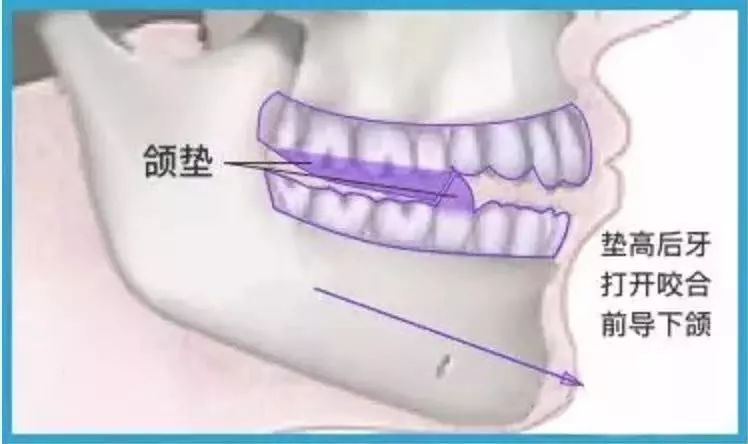 被嘴毁了的绝世容颜,被嘴耽误颜值