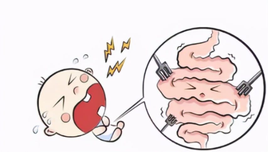 宝宝哭引起肠管扩张,宝宝哭的时候就会有脐疝