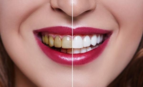 牙科诊所里你不知道的事,口腔医生提醒