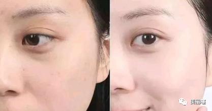 肌断食是什么意思？偶尔不涂护肤品，皮肤真的会变好吗？