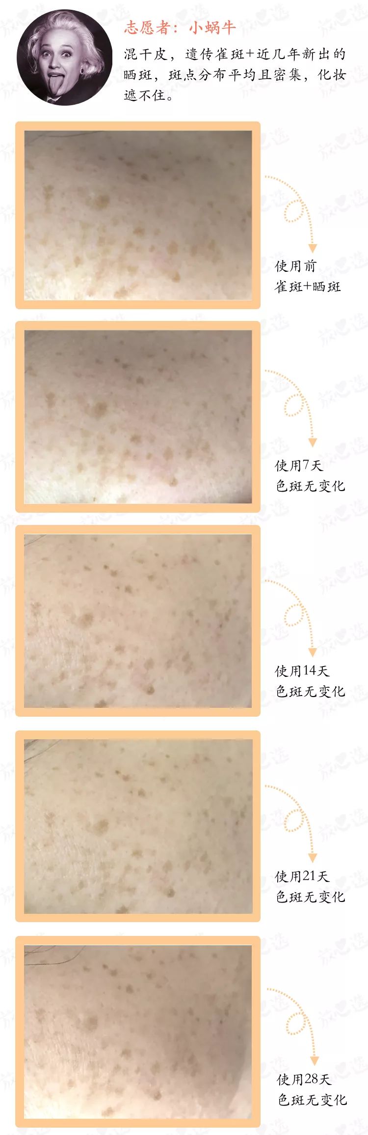 邓紫棋祛斑最快的方法,邓紫棋推荐淡斑