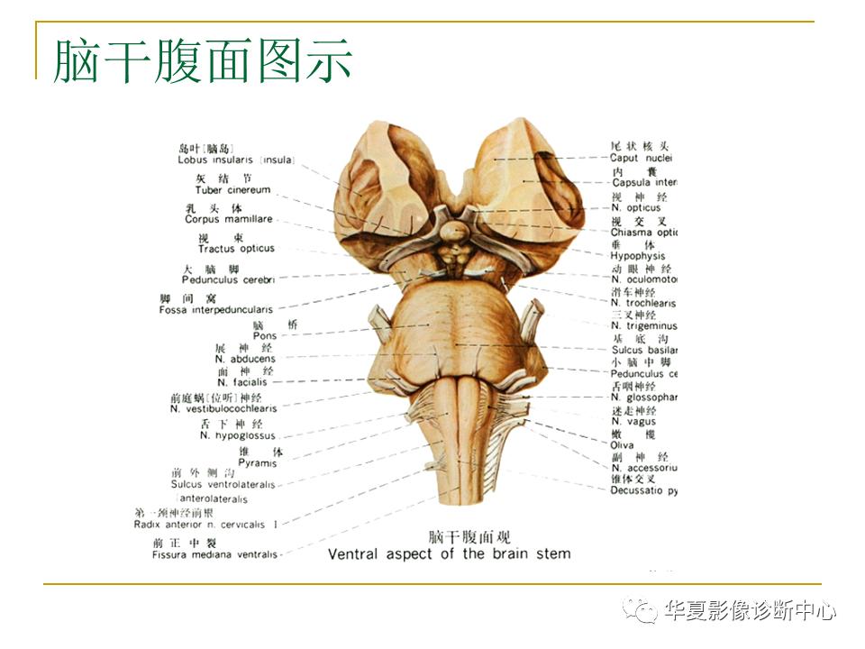 中国人脑立体定向mri应用解剖图谱,脑mri示意图