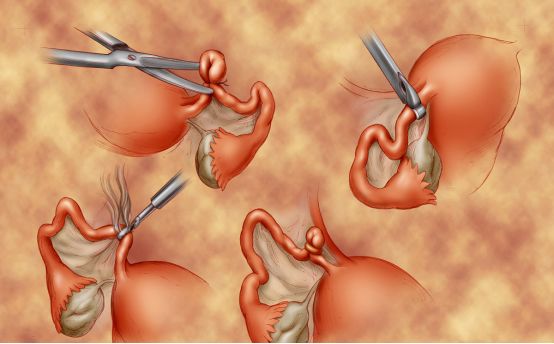 健康避孕小知识,产后避孕的十大建议