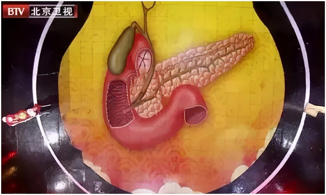 这些炎症可能比癌症更可怕，发病快、致死率高！用好餐桌上的“天然消炎剂”，给身体“消消炎”