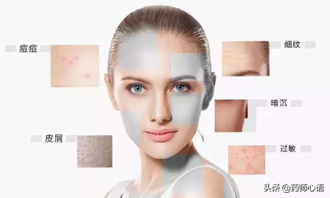 冬季孩子皮肤干燥瘙痒的治疗方法,冬季脸干燥瘙痒起疙瘩怎么急救