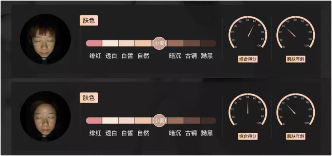 小茂肌诊室∣美容仪挑战：家用美容仪到底值得投资吗？