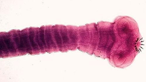 绦虫是怎么繁殖的,绦虫为什么会寄生在人类身上