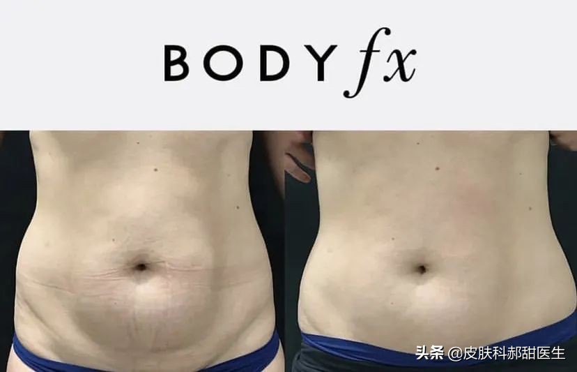 漾格医美皮秒怎么样,漾格医美场景视频