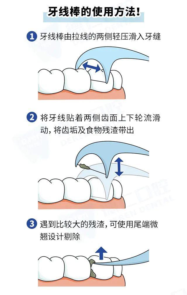 戴牙套的110天说说,戴隐形牙套第一周