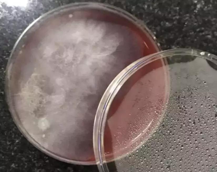 mngs病原检测的优势,mngs真的可靠吗