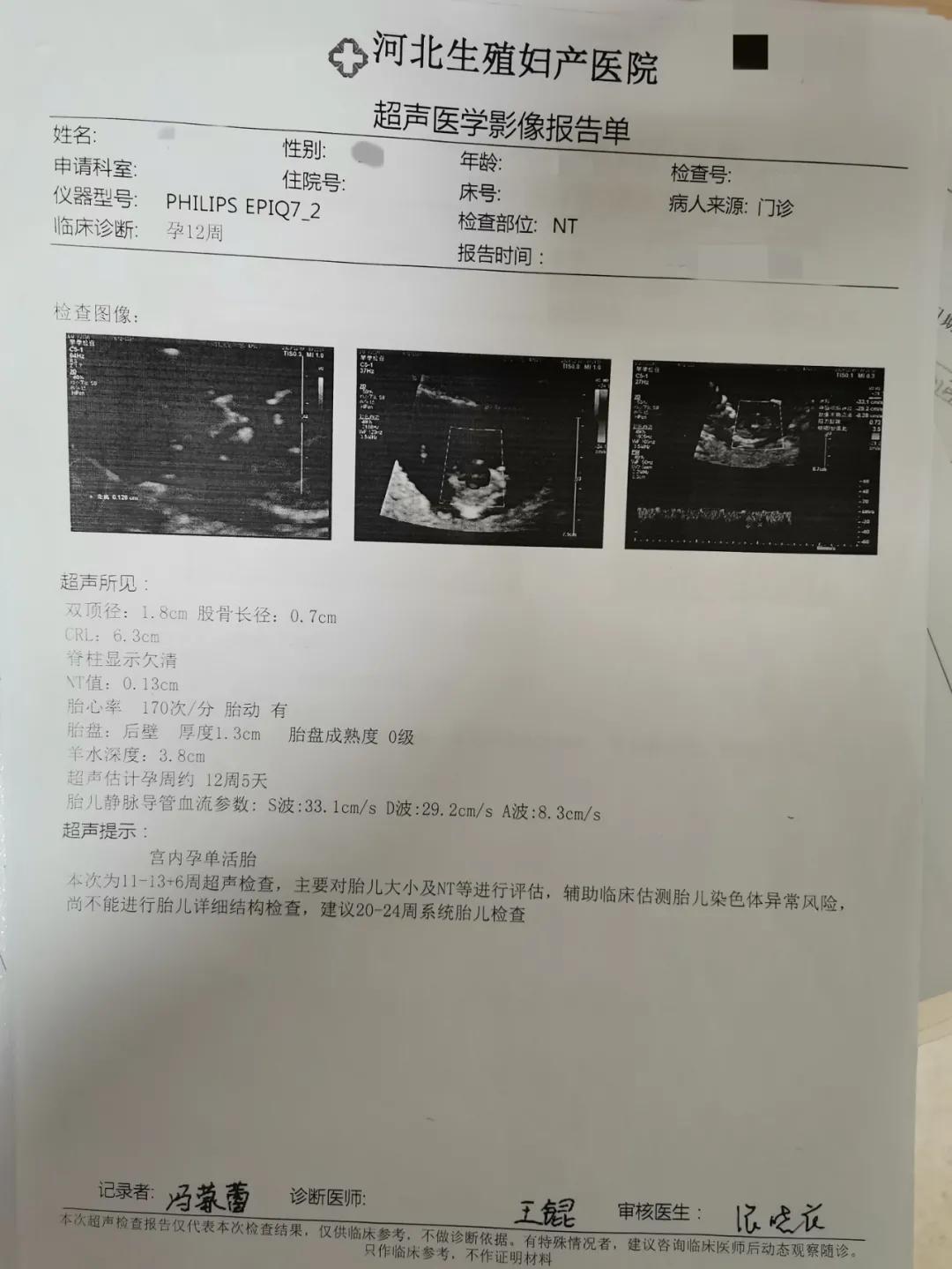 「好孕案例」一个卵泡，取卵一个，移植一个胚胎，成功怀孕