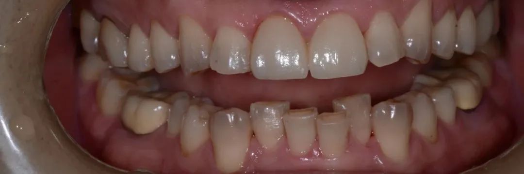 美白牙膏去牙黄真实有效测评,美白牙膏真实测评护牙效果