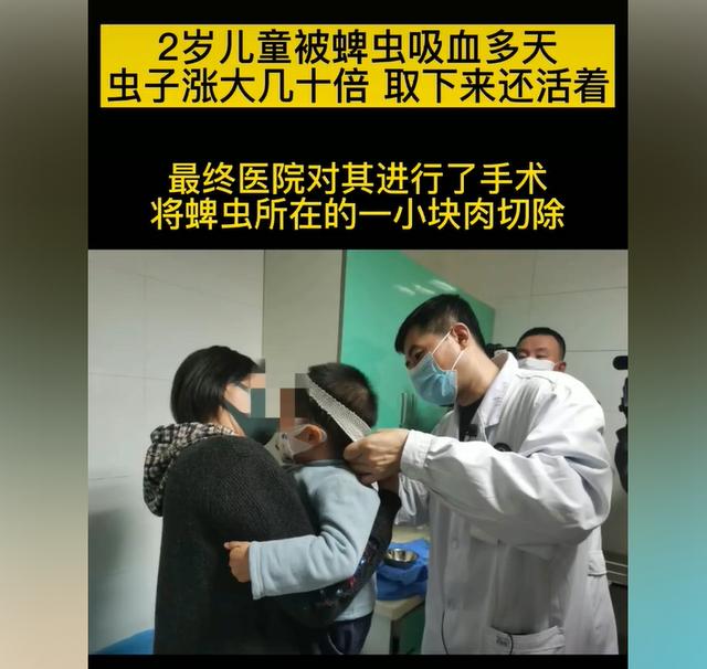 孩子被蜱虫幼虫咬了有事吗,小孩被蜱虫叮咬后怎么处理