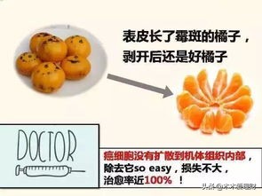 重疾新规精讲,重疾险里的原位癌很重要吗