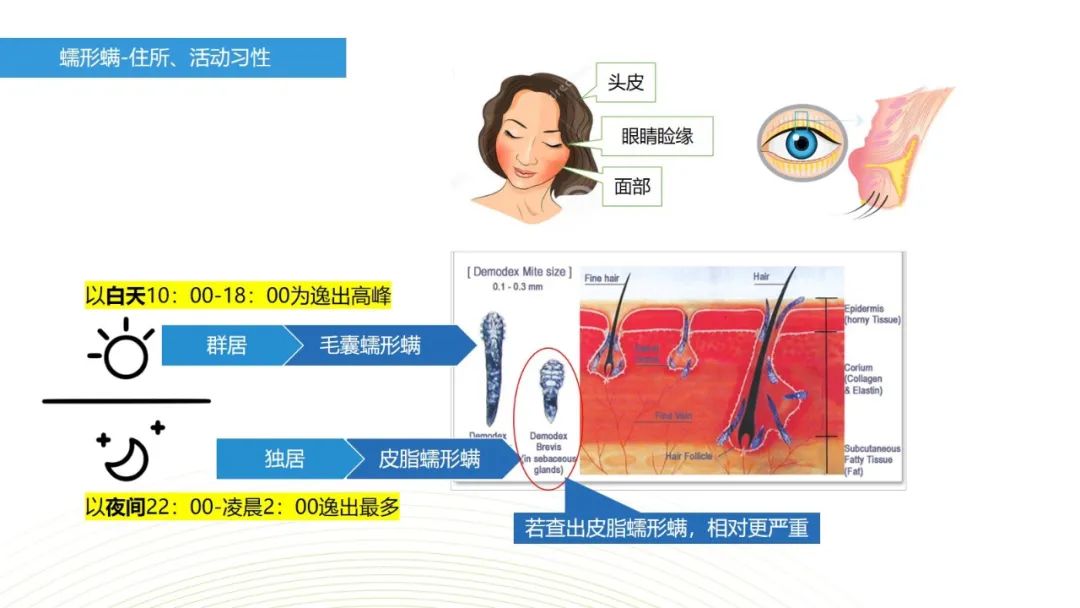 眼睛总是痒？总感觉眼睛里有东西？结膜炎角膜炎反反复复？可能是你的眼睛里有螨虫